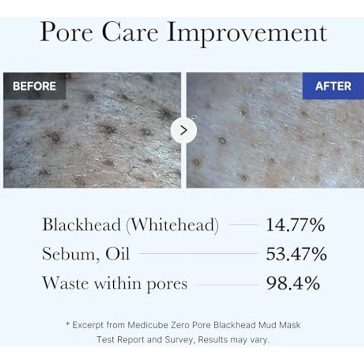 Medicube Zero Pore Blackhead Mud Mask - Reinigende Gesichtsmaske mit Tonerde, AHA+BHA+PHA - 100 g – Bild 5