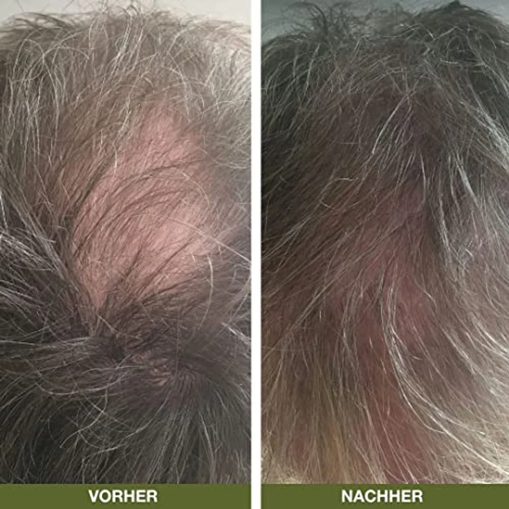 Australian Bodycare Hair Loss Serum – Bild 3