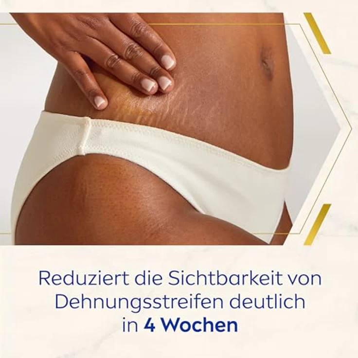 NIVEA LUMINOUS630® Body Creme Anti-Dehnungsstreifen & -Pigmentflecken, Bodylotion gleicht Unterschiede im Hautton aus, leichte Textur und spendet 48h Feuchtigkeit (200 ml) – Bild 3