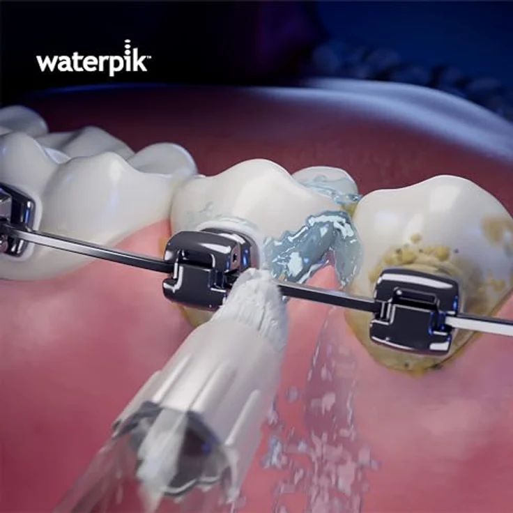 Waterpik WOD-2E Whitening Professional Water Flosser Munddusche Düsen Orthodontic Aufsätze zur Zahnaufhellung – Bild 5