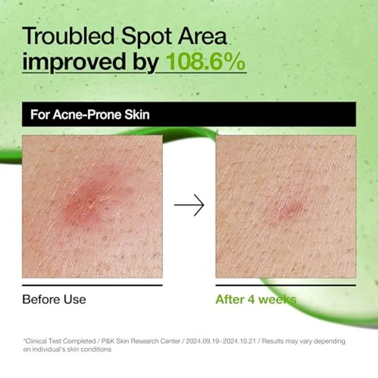 Anua Azelaic Acid 10+ Hyaluron Redness Soothing Serum, 30 ml, beruhigendes Gesichtsserum für empfindliche Haut – Bild 5