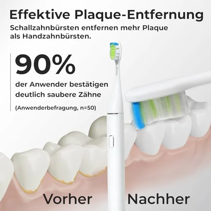 WhyteDOT® Premium Schallzahnbürste – sanft & effektiv, Aluminiumgehäuse, 72.000 Vibrationen/Min., UV-Reiseetui, bis zu 6 Wochen Akkulaufzeit – Bild 4