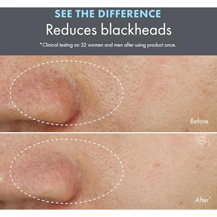 Origins Clear Improvement Blackhead Clearing Mask-To-Scrub, Gesichtspeeling für fettige Haut mit Salicylsäure und Bambuskohle, 75 ml – Bild 6