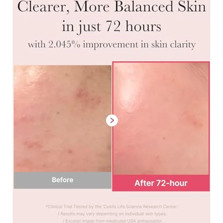 Medicube TXA Niacinamide 15 Serum 30 ml, Gesichtsserum mit 15% Wirkstoffkomplex, vegan, parfümfrei für strahlend ebenmäßige Haut – Bild 3