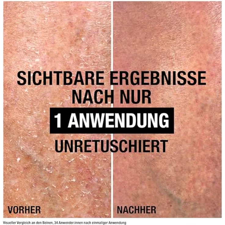 Neutrogena Intense Repair Reparierender CICA Bodybalsam, feuchtigkeitsspendende Bodylotion mit Glycerin & Centella Asiatica, nicht fettend, 250 ml, für raue, sehr trockene Haut – Bild 3