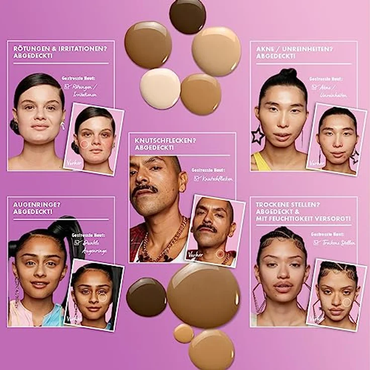 NYX Professional Makeup Abdeckendes Serum mit natürlichem Finish und mittlerer Deckkraft, Concealer gegen Unreinheiten, Augenringe und Rötungen, Bare With Me, Medium Golden, 1 x 9,6 ml – Bild 2