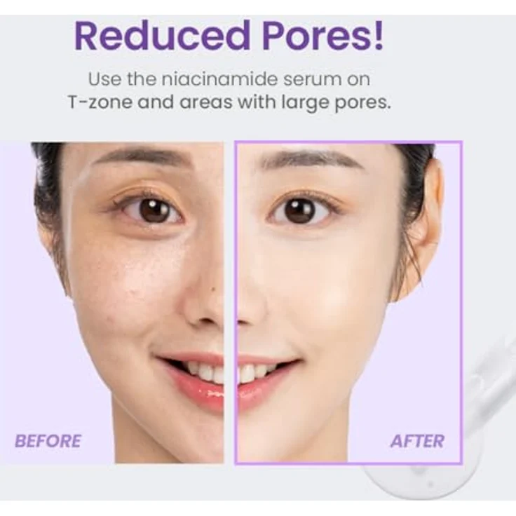 TIRTIR Niacinamide 20% Serum, Aufhellendes Anti-Falten-Serum mit festigender Wirkung, 30 ml – Bild 5