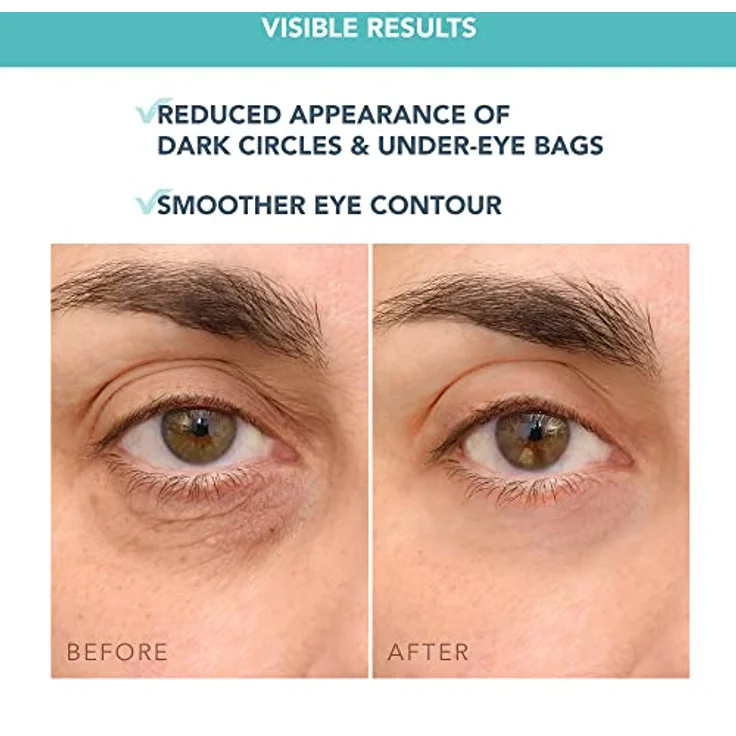FOREO IRIS Vitamin C Eye Cream - Augencreme Gegen Falten und Augenringe - Vitamin E - Koffein - Hyaluronsäure - Yerba Mate - Kakaobutter - Vegan Kosmetik - Augenringe Entfernen und Tränensäcke - 15 ml – Bild 5