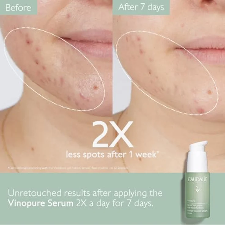 Caudalie Vinopure Skin Perfecting Serum Gesichtsserum 30 ml – Bild 2