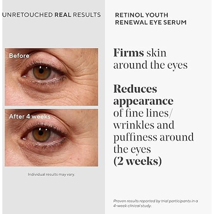 Murad Augenserum mit Retinol Tri-Active Technology, 15 ml, Tag + Nacht, zur Reduzierung von Falten und Krähenfüßen – Bild 3