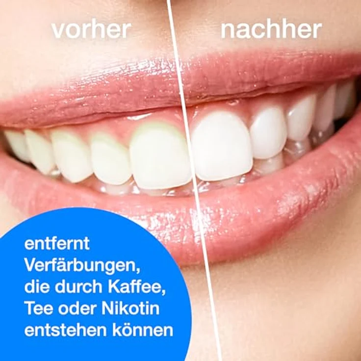 Wellsamed Stain Remover Zahnsteinentferner Zahnpolierer Interdentalbürsten – Bild 7