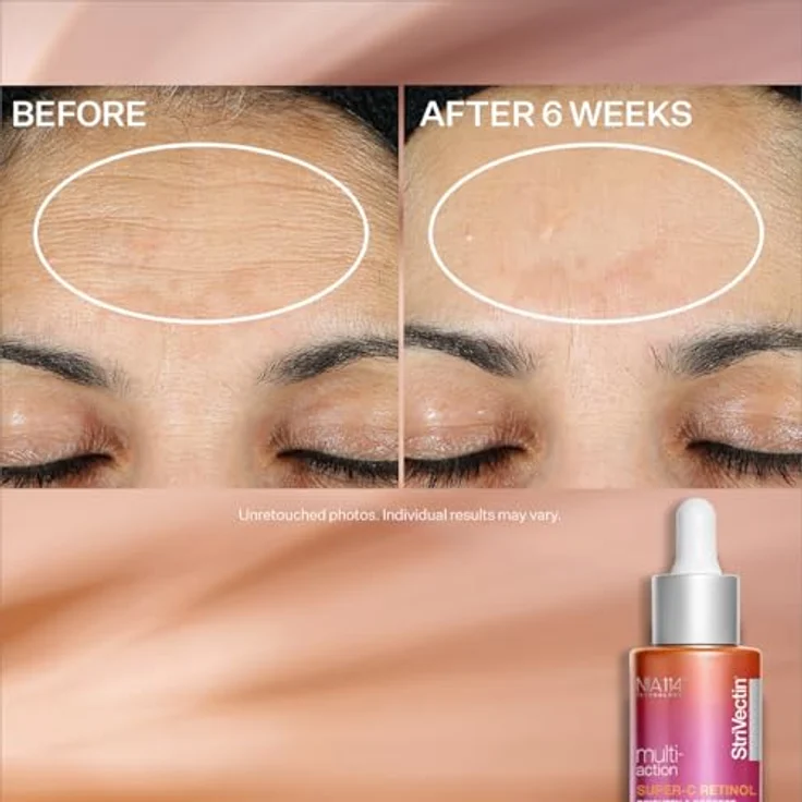 StriVectin Multi-Action Super-C Retinol Brighten & Correct Vitamin C Serum Anti-Aging Gesichtsserum 30 ml mit hautverjüngernder Wirkung – Bild 8
