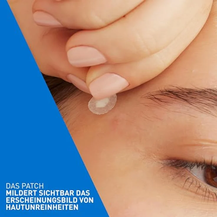 CeraVe Anti-Unreinheiten Patches, transparente Hydrokolloid-Pickel-Pflaster mit Niacinamid für unreine und zu Akne neigende Haut – Bild 5
