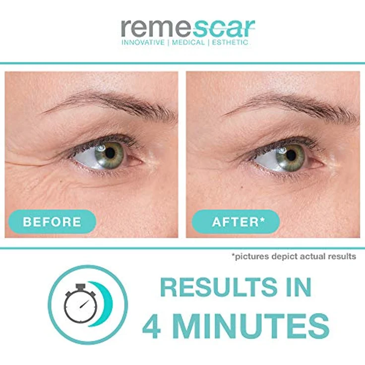 Remescar Augencreme für Krähenfüße 8g - Klinisch nachgewiesene Augencreme zur Reduzierung von Krähenfüßen - Anti-Aging-Augencreme für Männer & Frauen - Filler gegen feine Linien & Fältchen – Bild 3