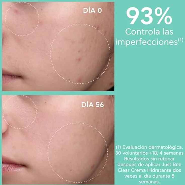 Apivita Just Bee Clear Blemish Control Mattifying Moisturizer, Gel-Creme für fettige Haut, Akne & Unreinheiten, 40ml mit patentiertem Propolis AMC & pflanzlicher Salicylsäure – Bild 5