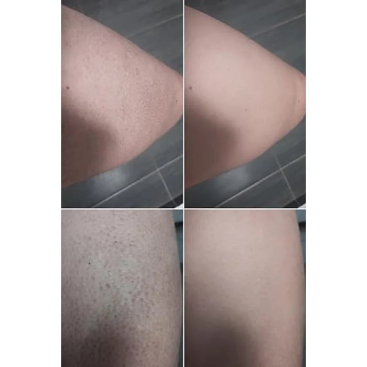 Australian Bodycare Salicylic Acid Keratosis Wash, Duschgel für Unisex mit Peeling-Effekt, 200 ml – Bild 8