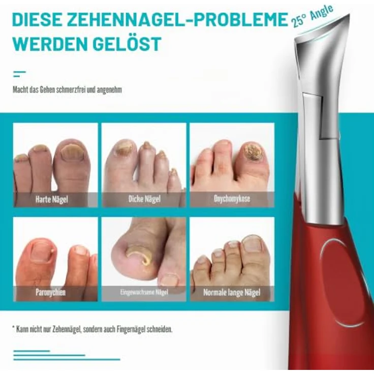 RONAVO Fussnagelzange Profi, Orthopädische Edelstahl-Nagelschere für dicke und eingewachsene Fußnägel, rutschfester Griff, Ledertasche zur sicheren Aufbewahrung – Bild 3