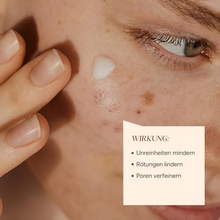 JUNGLÜCK Azelain Serum, Vegan Gesichtsserum mit 10% Azelaic Acid, beruhigend gegen Pickel & Rötungen, mattiert öligen Glanz, für empfindliche und unreine Haut – Bild 5