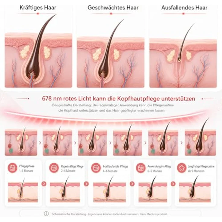 COOL-i ® Infrarotlampe Rotlicht-Haarwuchshaube, kabellos mit 158 LEDs, Infrarot- & Blaulichttherapie für die Kopfhaut, wiederaufladbar, Timer, für Männer & Frauen – Bild 7