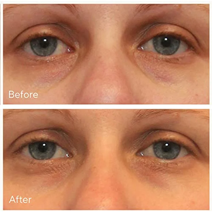 MURAD Serum & Treatments MURAD Serum & Treatments Vita-C Eyes Dark Circle Augenserum 15 ml – Bild 3