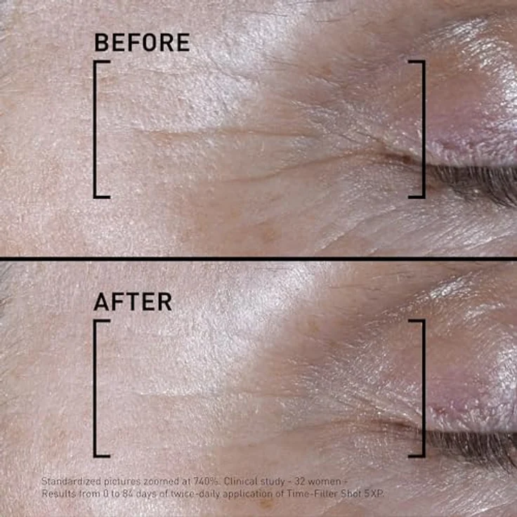 FILORGA TIME-FILLER SHOT, Intensiv-Serum gegen Hautalterung mit hoher Konzentration aktiver Inhaltsstoffe, 15 ml – Bild 4