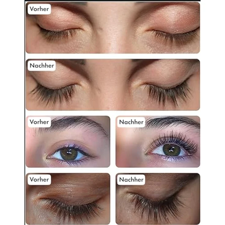 Toplash XL Wimpern- und Augenbrauen-Booster, Wachstumsserum mit natürlichen Potanicals und Peptiden, 6 ml – Bild 4