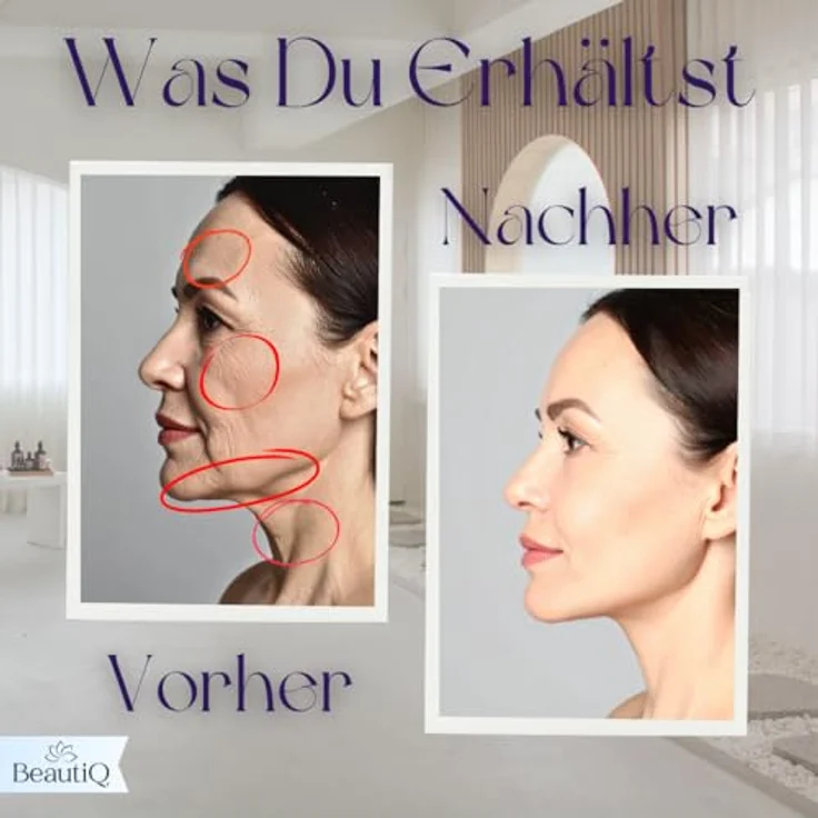 Winch Massagegerät [Neuheit] Beauty Deluxe, LED-Therapie, Vibrations-, Wärme- & Kältefunktion, strahlende Haut – Bild 6