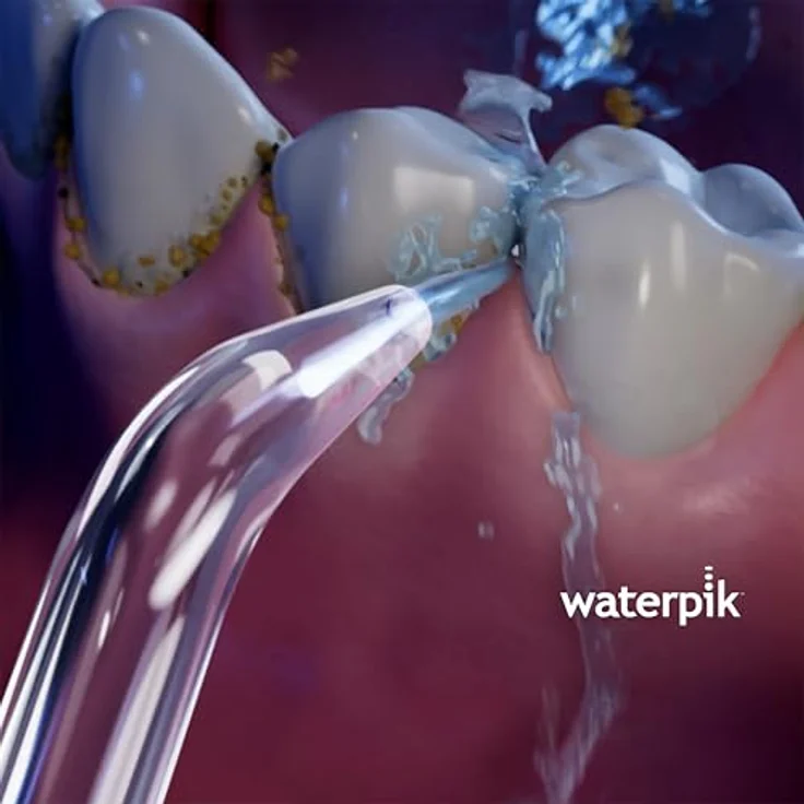 Waterpik Classic High-Press JT-450 2er-Pack, zur gründlichen Interdentalreinigung – Bild 5