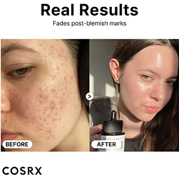 COSRX Niacinamide 15% Gesichtsserum, Verkleinert vergrößerte Poren, Beruhigt Rötungen, Korrigierende Behandlung von Verfärbungen, 20 ml, Korean Skincare – Bild 3