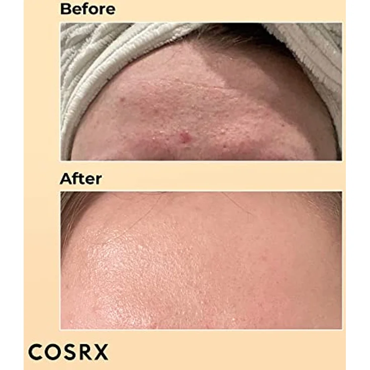 Cosrx Advanced Snail 96 Mucin Power Essence 100 ml, mit feuchtigkeitsspendender Wirkung – Bild 3