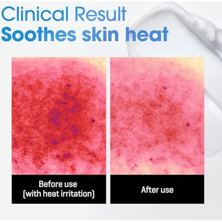 SOME BY MI Beta-Panthenol Repair Körpercreme 200ml – Beruhigende, feuchtigkeitsspendende Lotion für empfindliche Haut – Lindert Rötungen, stärkt die Hautbarriere – Koreanische Hautpflege – Bild 2
