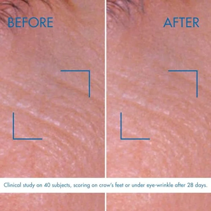 Biotherm Pro-Retinol Augencreme, straffende Augencreme mit Life Plankton, glättende Augenpflege für eine frische Ausstrahlung, 15ml – Bild 4