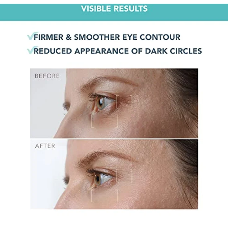 IRIS Straffendes Augenserum für Nachts - Retinol - Pilzextrakt - Vitamin E - Bakuchiol - Augenringe entfernen - Augenringe & Tränensäcke - O. Duftstoffe - Alle Hauttypen - 15 ml – Bild 5