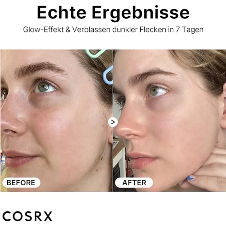 Cosrx Vitamin C 23 Serum, Gesichtsserum mit 23% reinem Vitamin C, Hyaluronsäure & Super Vitamin E, 20 g – Bild 4