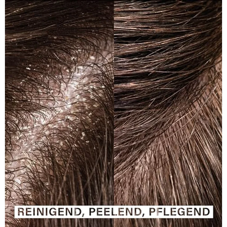 Rosental Organics Exfoliating Hair Brush - Kopfhaut Massagebürste & Peeling - Shampoo Haarbürste - Haarwaschbürste - Gegen Schuppen - Hilft bei Haarwachstum - 100% Silikon, Schwarz – Bild 2