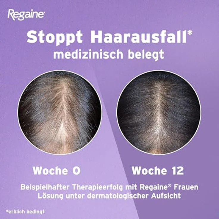 Regaine Frauen Lösung: Stoppt erblich bedingten Haarausfall und regt neues Haarwachstum an, 60 ml – Bild 3