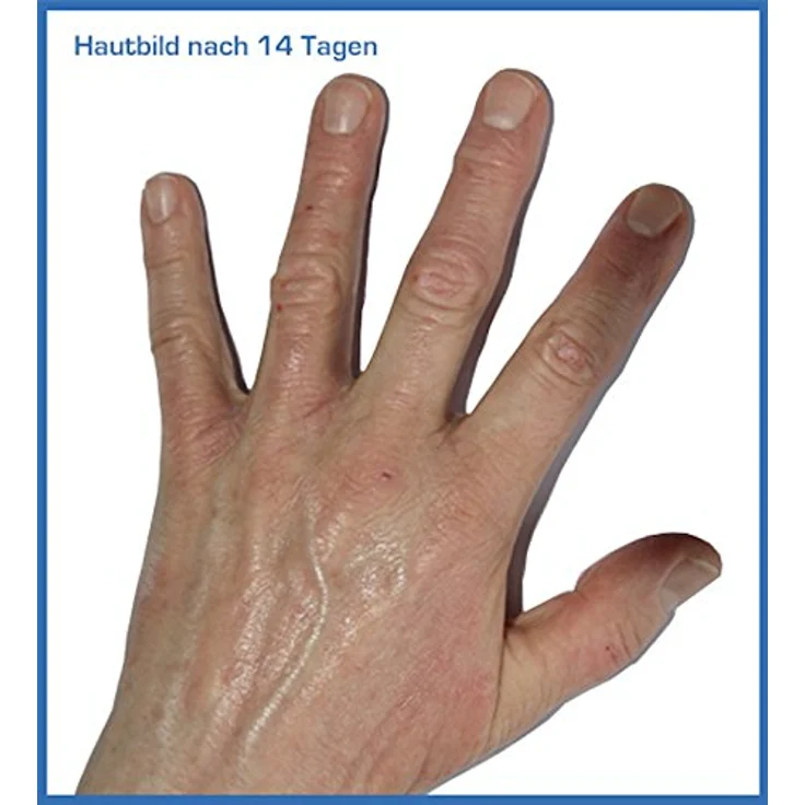 Prontomed SoleaDerm Creme 100ml | bei Neurodermitis & Psoriasis | mit Reiskeimöl & 5% Urea, dermatologisch getestet – Bild 3