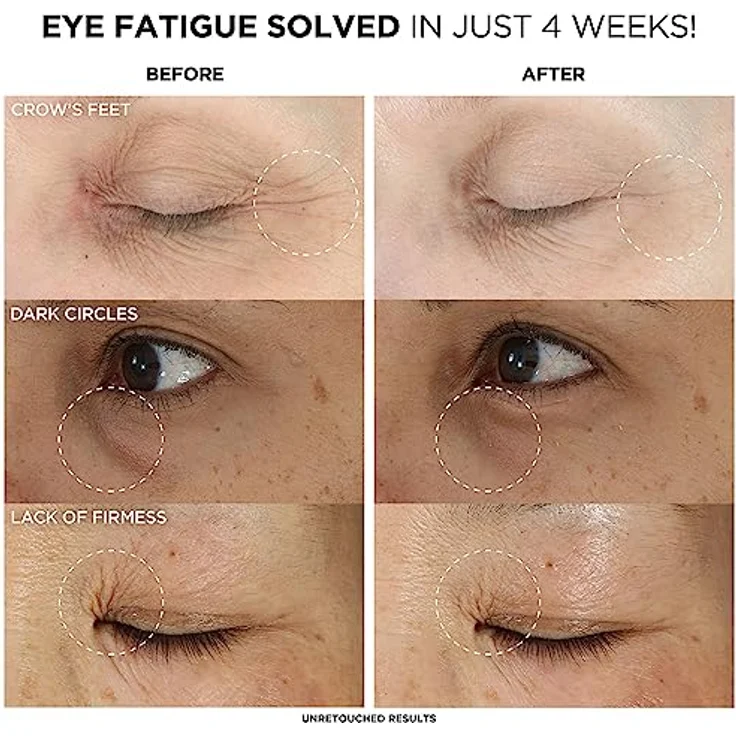 IT Cosmetics Confidence In An Eye Cream, feuchtigkeitsspendende Augencreme mit 2 % Super Peptiden, für alle Hauttypen, 15 ml – Bild 2