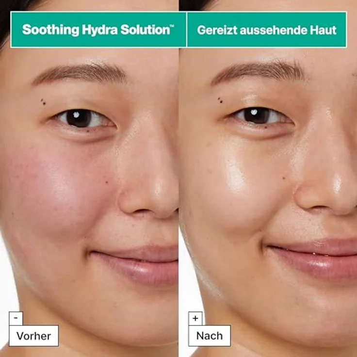 Dr. Jart+ Soothing Hydra Solutionâ„¢ Intensive Soothing Mask, regenerierende und feuchtigkeitsspendende Gesichtsmaske, 26 g – Bild 4