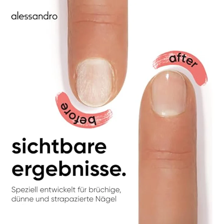 alessandro SOS Nail Repair Serum, Nagelserum für brüchige Nägel mit Biotin, AHA & marinem Silizium, schnelltrocknend, sichtbare Ergebnisse nach 3-6 Tagen, vegan, 10ml – Bild 4