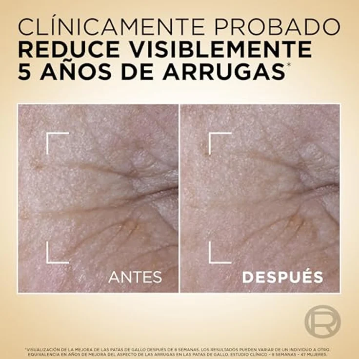 L'Oréal Paris Age Perfect Rejuvenating Serum Le Duo, Anti-Aging Gesichtsserum mit zwei starken Wirkstoffen, 30 ml – Bild 4