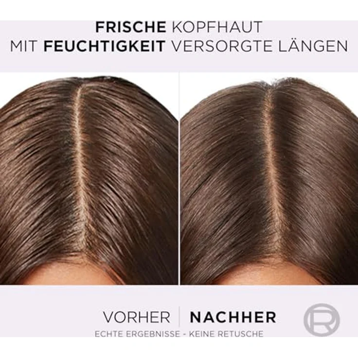 L'Oréal Paris Elvital Hydra Hyaluronic Pure, Feuchtigkeitsspendende Spülung mit Salicylsäure und Hyaluronsäure für fettige Kopfhaut und trockene Längen, 6 x 250 ml – Bild 2