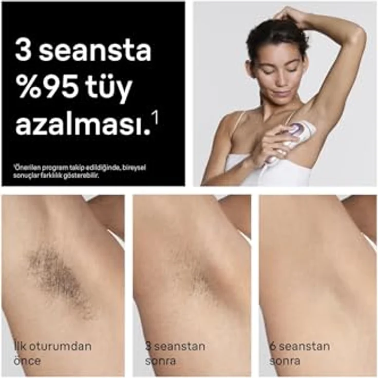 Braun Smart IPL Skin i·expert PL7432, intelligenter IPL-Haarentferner für Körper, Gesicht, Bikini- und Achselbereich, schmerzfreie Haarentfernung, mehrere Intensitätsstufen, App-kompatibel – Bild 6