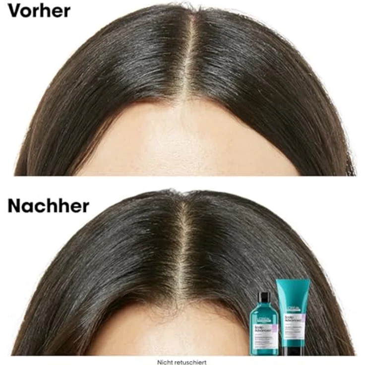 L'Oréal Professionnel Scalp Advanced, Anti-Discomfort Dermo-Regulator Shampoo zum Nachfüllen, 500ml - Beruhigt empfindliche Kopfhaut – Bild 4