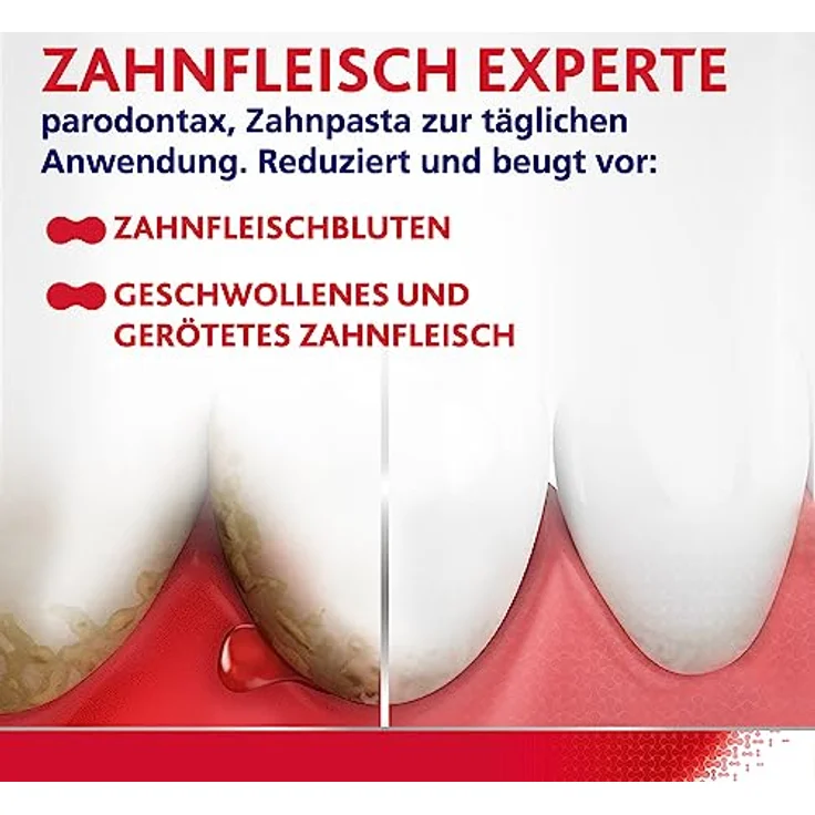 Parodontax Ultra Clean, Zahnpasta zur Reduktion von Zahnfleischbluten, 75ml – Bild 3