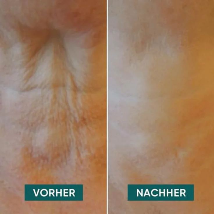 APRICOT it's neck or nothing Hals Pad Silikonpad – Bild 6