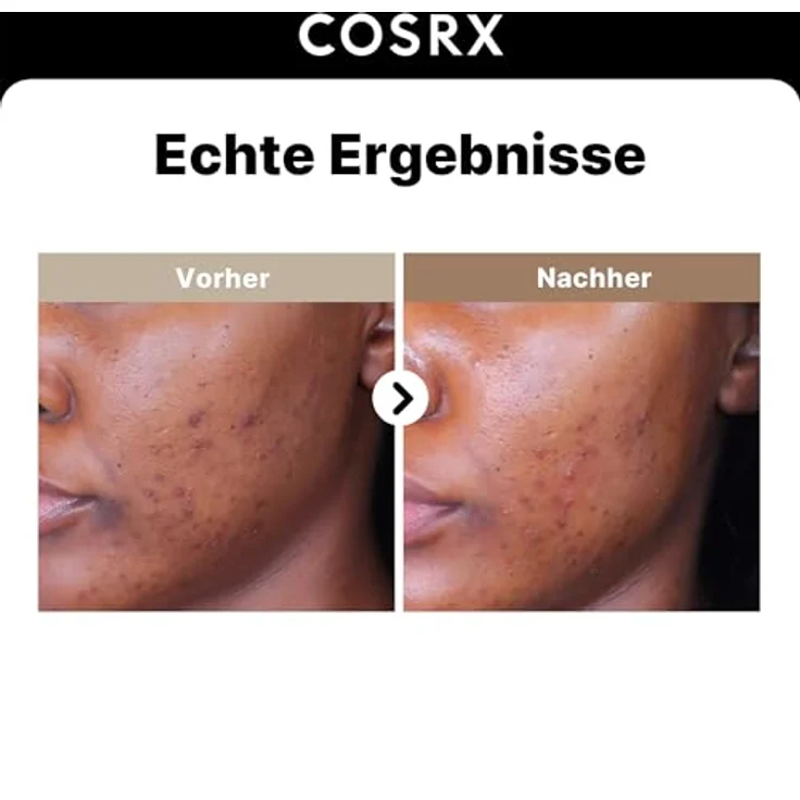 Cosrx The Alpha-Arbutin 2 Discoloration Care Serum, 50ml - Skin-Glow Serum zur Reduzierung von dunklen Flecken und Hyperpigmentierung – Bild 2