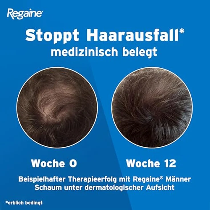 Regaine Männer Schaum: 3-Monatspackung mit 50 mg/g Minoxidil, stoppt erblich bedingten Haarausfall bei Männern und regt das Haarwachstum an, 3 x 60 g – Bild 4
