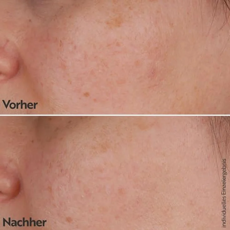 M. Asam VITAMIN C Intense 10% Serum (30ml) – Hochdosiertes Anti-Aging Serum für strahlenden Glow, feuchtigkeitsspendend, ideal für alle Hauttypen – Bild 3