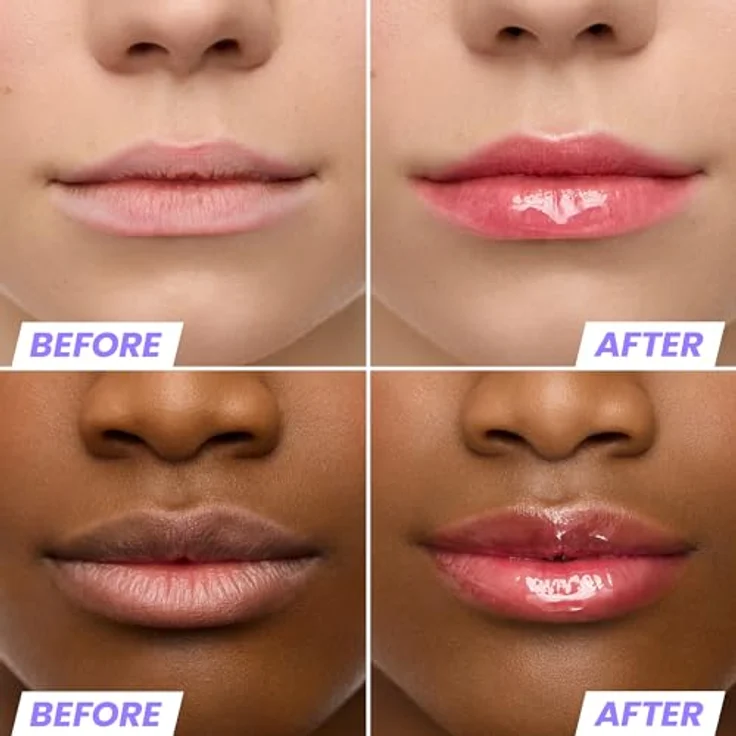 Wonderskin Lip Rehab Serum Oil, Getöntes Lippenöl mit roter Tönung, feuchtigkeitsspendend und pflegend für trockene Lippen (Amour) – Bild 3